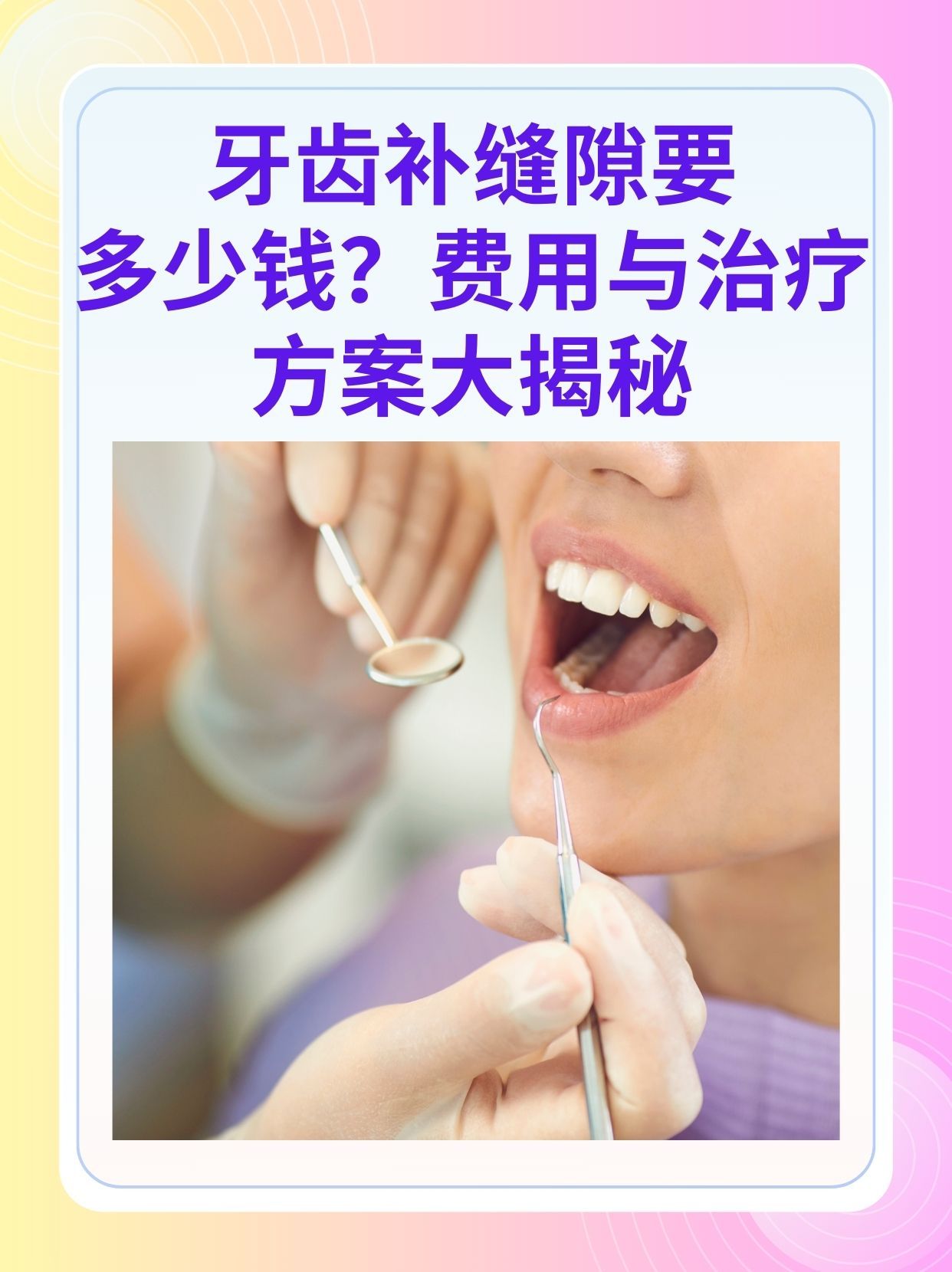 新乡补牙医保可以报销吗(补牙医保可以报销吗 哪些可以报销呢)